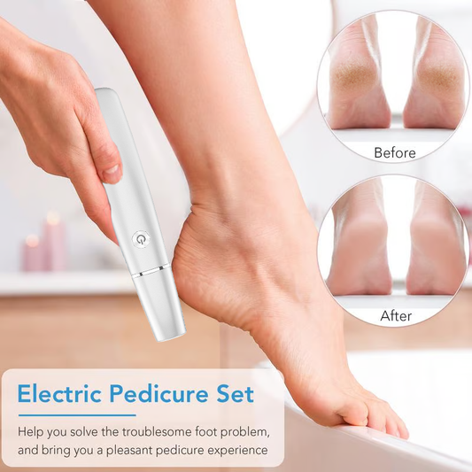 DermaSmooth™  Electric Callus Remover
