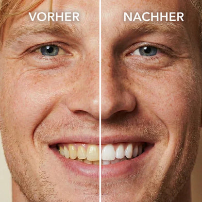 The Brighter Tooth Polish