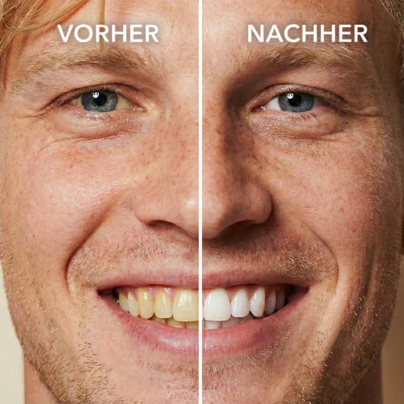 The Oral Brightener Spray Polish
