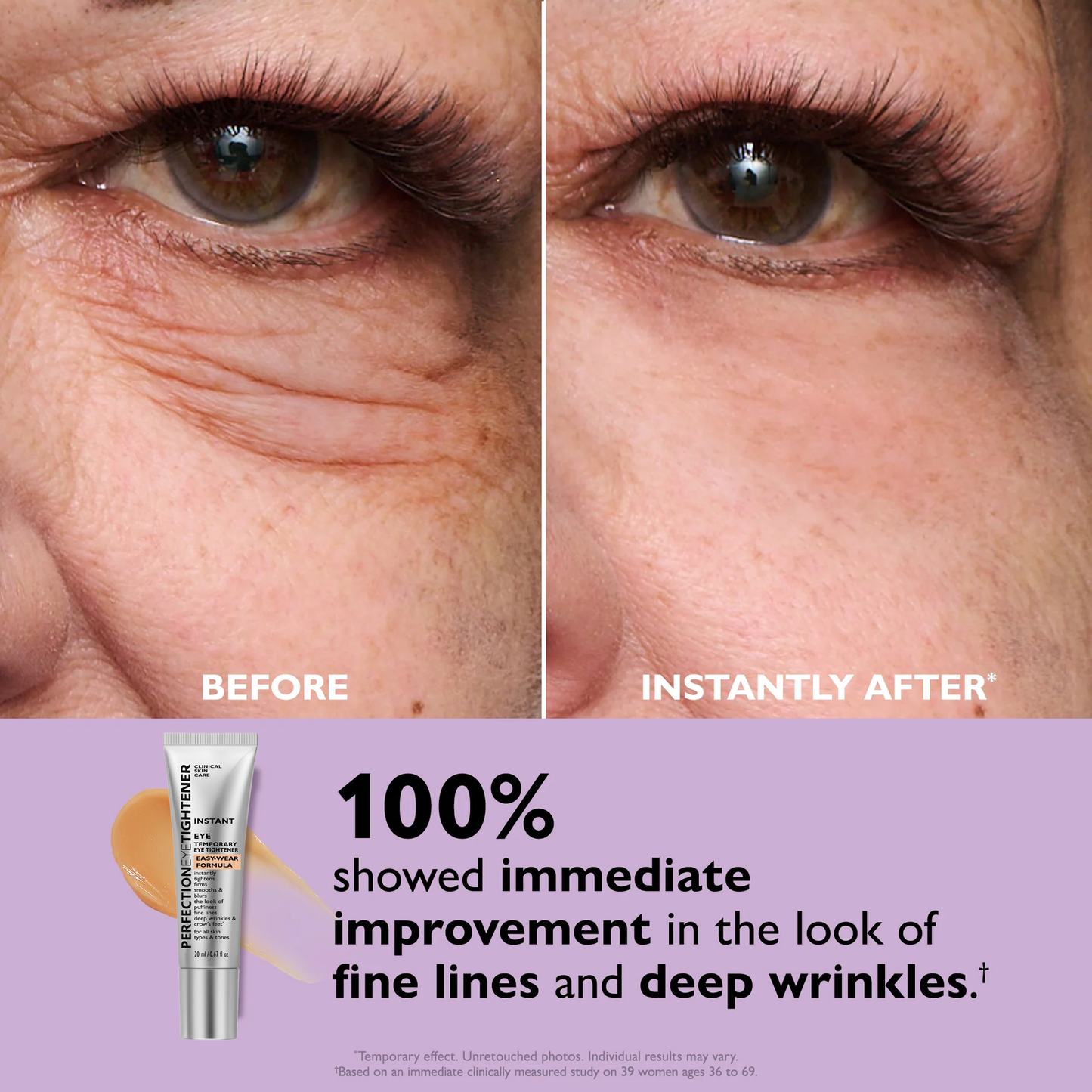 Perfection Eye Tightener