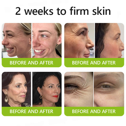 The (VIRAL) Vita A Retinal Cream