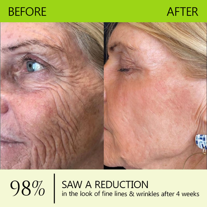 The (VIRAL) Vita A Retinal Cream