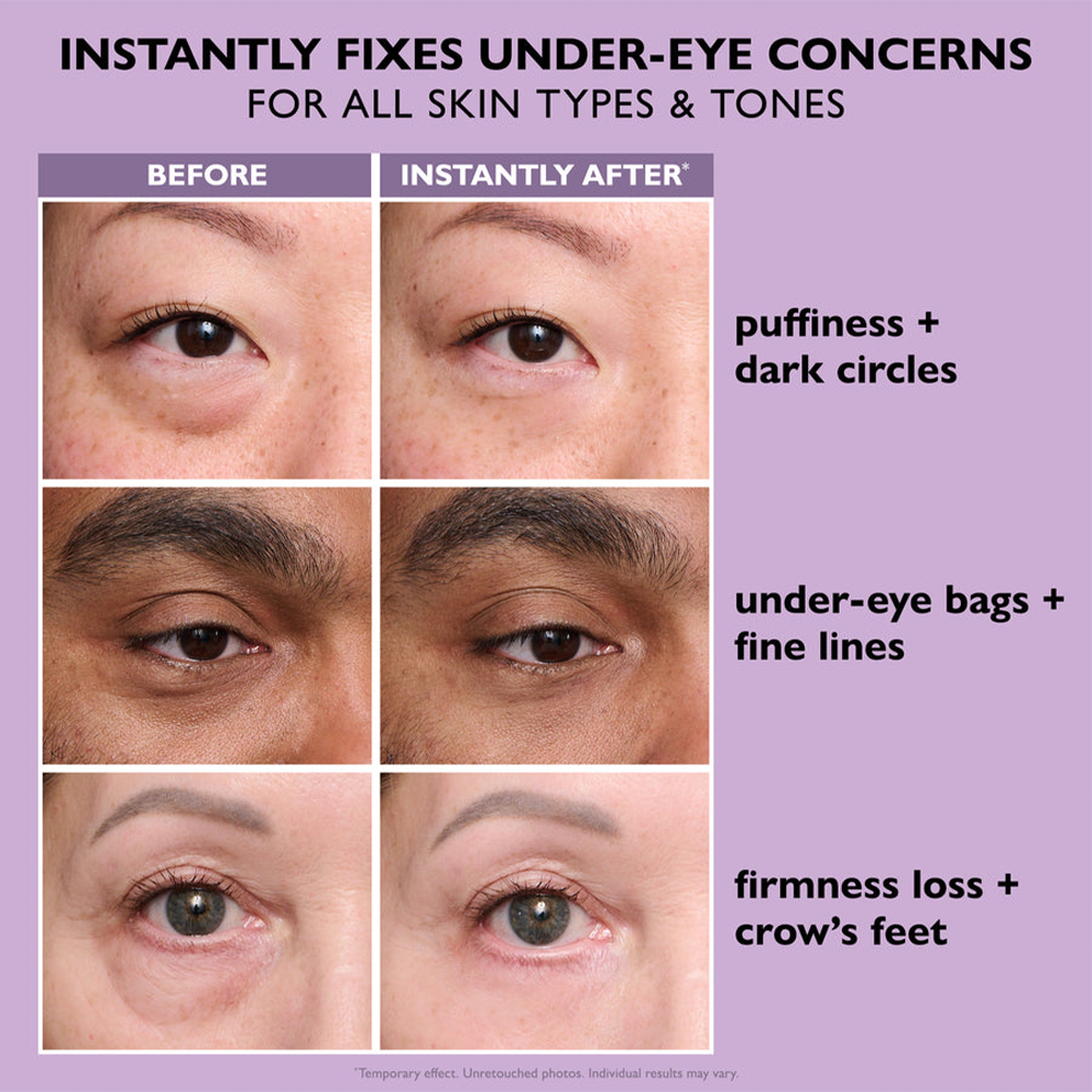 Perfection Eye Tightener