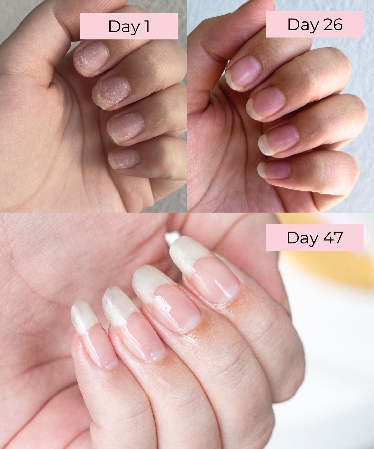 The 3ml Nail Growth Pen