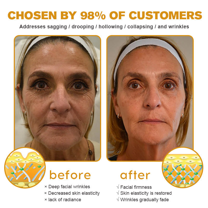 The (VIRAL) Bee Venom Wrinkle Cream