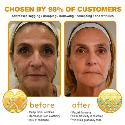 The (VIRAL) Bee Venom Wrinkle Cream