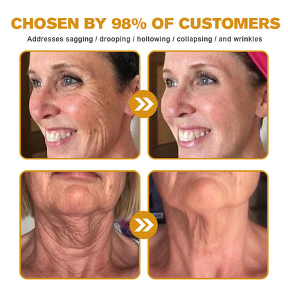 The (VIRAL) Bee Venom Wrinkle Cream